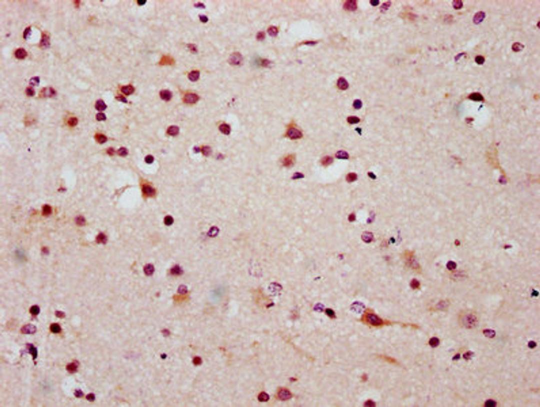 IHC image of CSB-PA010403OA20ncrHU diluted at 1:20 and staining in paraffin-embedded human brain tissue performed on a Leica BondTM system. After dewaxing and hydration, antigen retrieval was mediated by high pressure in a citrate buffer (pH 6.0). Section was blocked with 10% normal goat serum 30min at RT. Then primary antibody (1% BSA) was incubated at 4°C overnight. The primary is detected by a biotinylated secondary antibody and visualized using an HRP conjugated SP system.