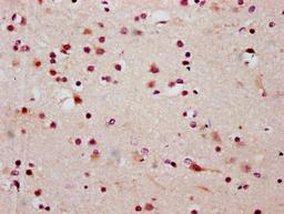 IHC image of CSB-PA010403OA20ncrHU diluted at 1:20 and staining in paraffin-embedded human brain tissue performed on a Leica BondTM system. After dewaxing and hydration, antigen retrieval was mediated by high pressure in a citrate buffer (pH 6.0). Section was blocked with 10% normal goat serum 30min at RT. Then primary antibody (1% BSA) was incubated at 4°C overnight. The primary is detected by a biotinylated secondary antibody and visualized using an HRP conjugated SP system.