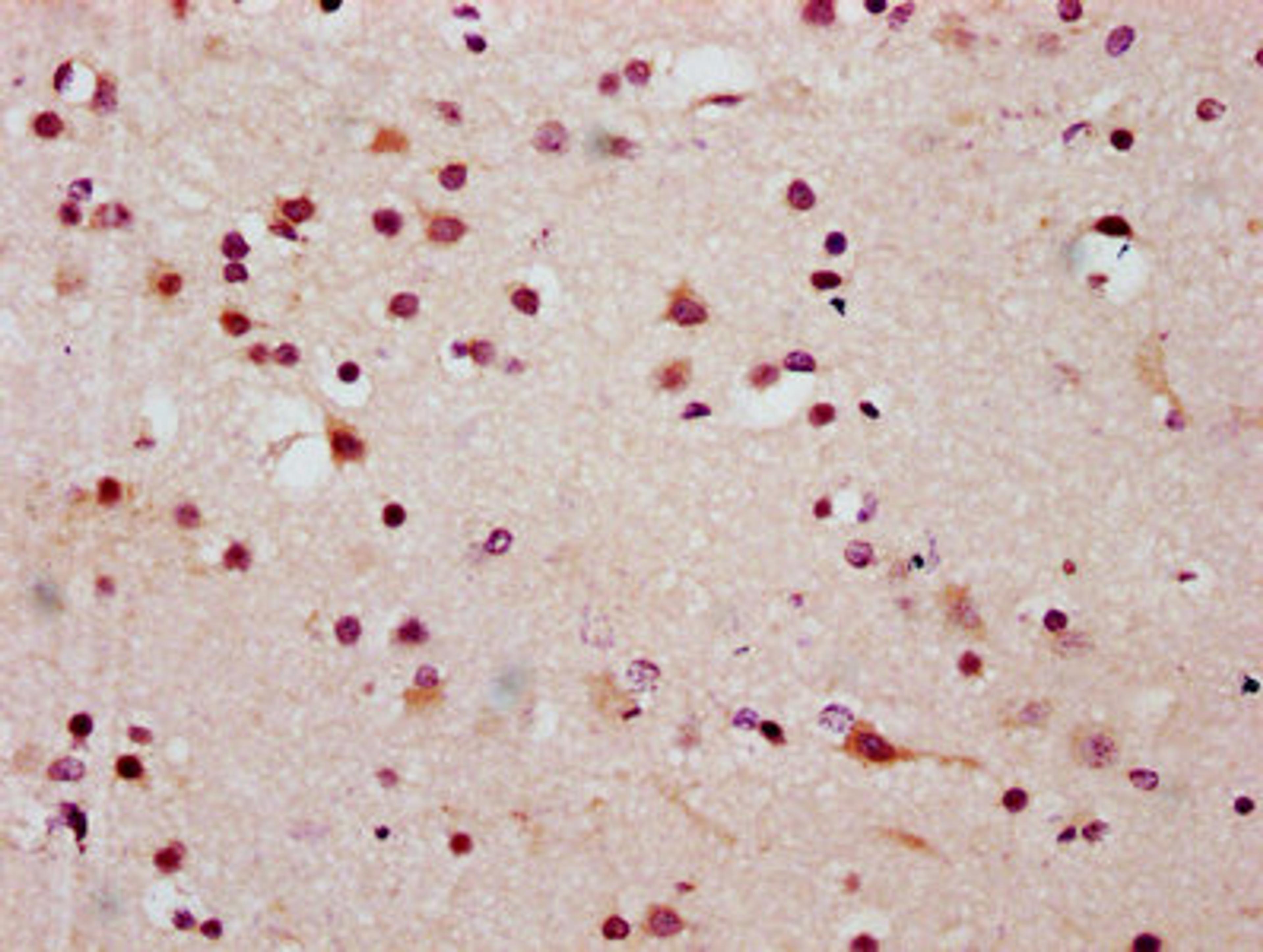 IHC image of CSB-PA010403OA20ncrHU diluted at 1:20 and staining in paraffin-embedded human brain tissue performed on a Leica BondTM system. After dewaxing and hydration, antigen retrieval was mediated by high pressure in a citrate buffer (pH 6.0). Section was blocked with 10% normal goat serum 30min at RT. Then primary antibody (1% BSA) was incubated at 4°C overnight. The primary is detected by a biotinylated secondary antibody and visualized using an HRP conjugated SP system.