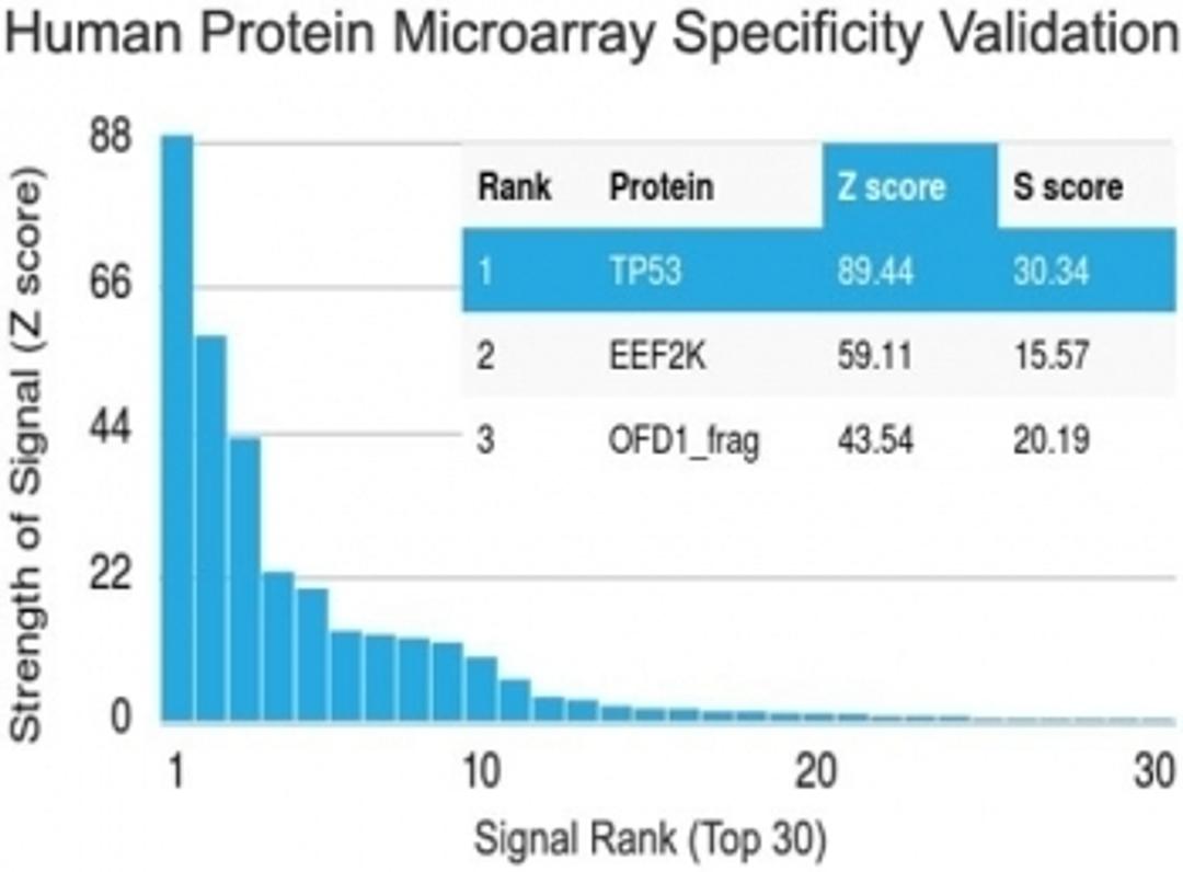 Analysis of HuProt(TM) microarray containing more than 19,000 full-length human proteins using TP53 antibody (clone TRP/816). Z- and S- score: The Z-score represents the strength of a signal that an antibody (in combination with a fluorescently-tagged an