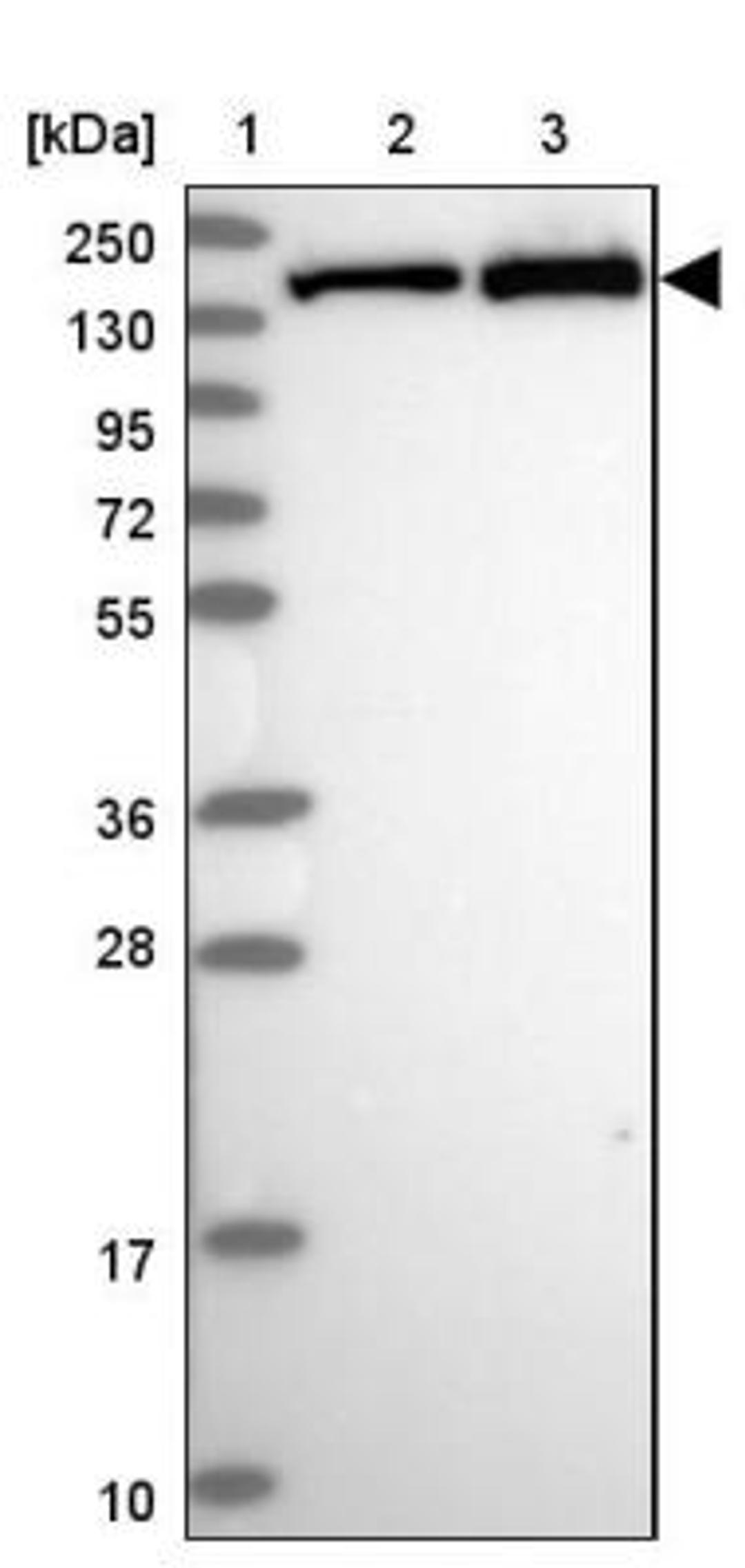 Aggregation: VARS Antibody [NBP2-13513] - Lane 1: Marker [kDa] 250, 130, 95, 72, 55, 36, 28, 17, 10<br/>Lane 2: Human cell line RT-4<br/>Lane 3: Human cell line U-251MG sp