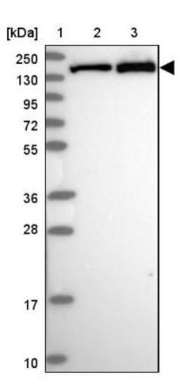 Aggregation: VARS Antibody [NBP2-13513] - Lane 1: Marker [kDa] 250, 130, 95, 72, 55, 36, 28, 17, 10<br/>Lane 2: Human cell line RT-4<br/>Lane 3: Human cell line U-251MG sp