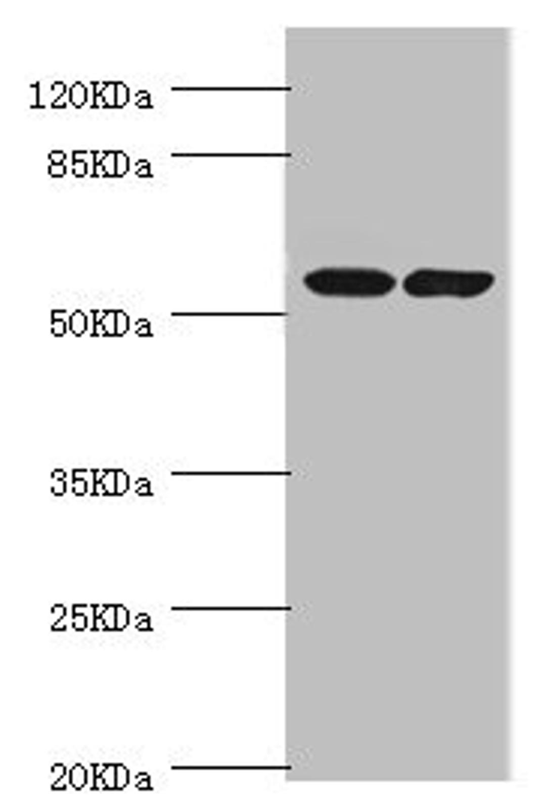 Western blot. All lanes: DPYS antibody at 1.1ug/ml. Lane 1: Mouse liver tissue. Lane 2: Mouse kidney tissue. Secondary. Goat polyclonal to rabbit IgG at 1/10000 dilution. Predicted band size: 57 kDa. Observed band size: 57 kDa. 