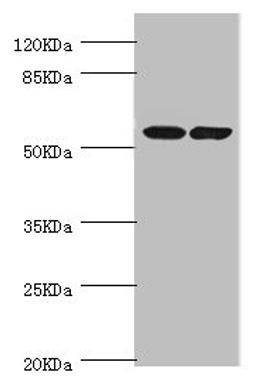 Western blot. All lanes: DPYS antibody at 1.1ug/ml. Lane 1: Mouse liver tissue. Lane 2: Mouse kidney tissue. Secondary. Goat polyclonal to rabbit IgG at 1/10000 dilution. Predicted band size: 57 kDa. Observed band size: 57 kDa. 
