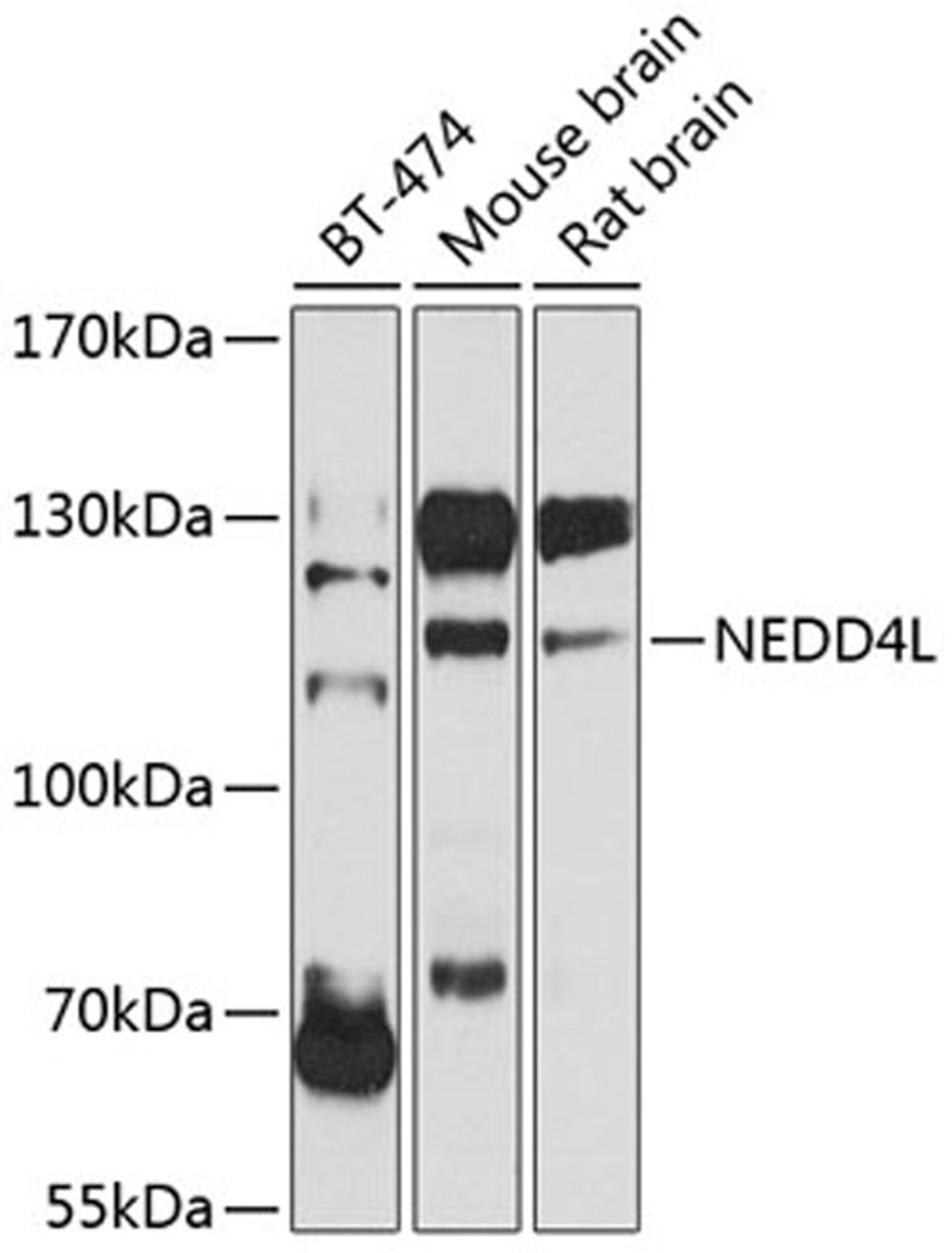 Western blot - NEDD4L antibody (A8085)