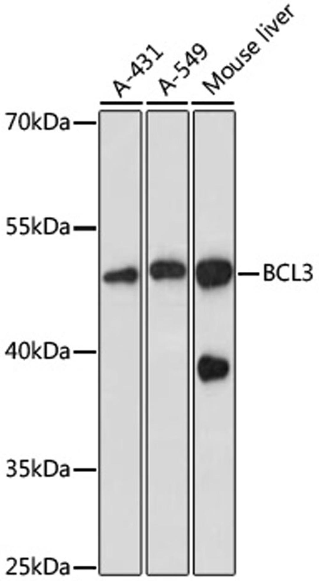 Western blot - BCL3 antibody (A11582)