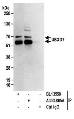 Detection of human UBXD7 by western blot of immunoprecipitates.