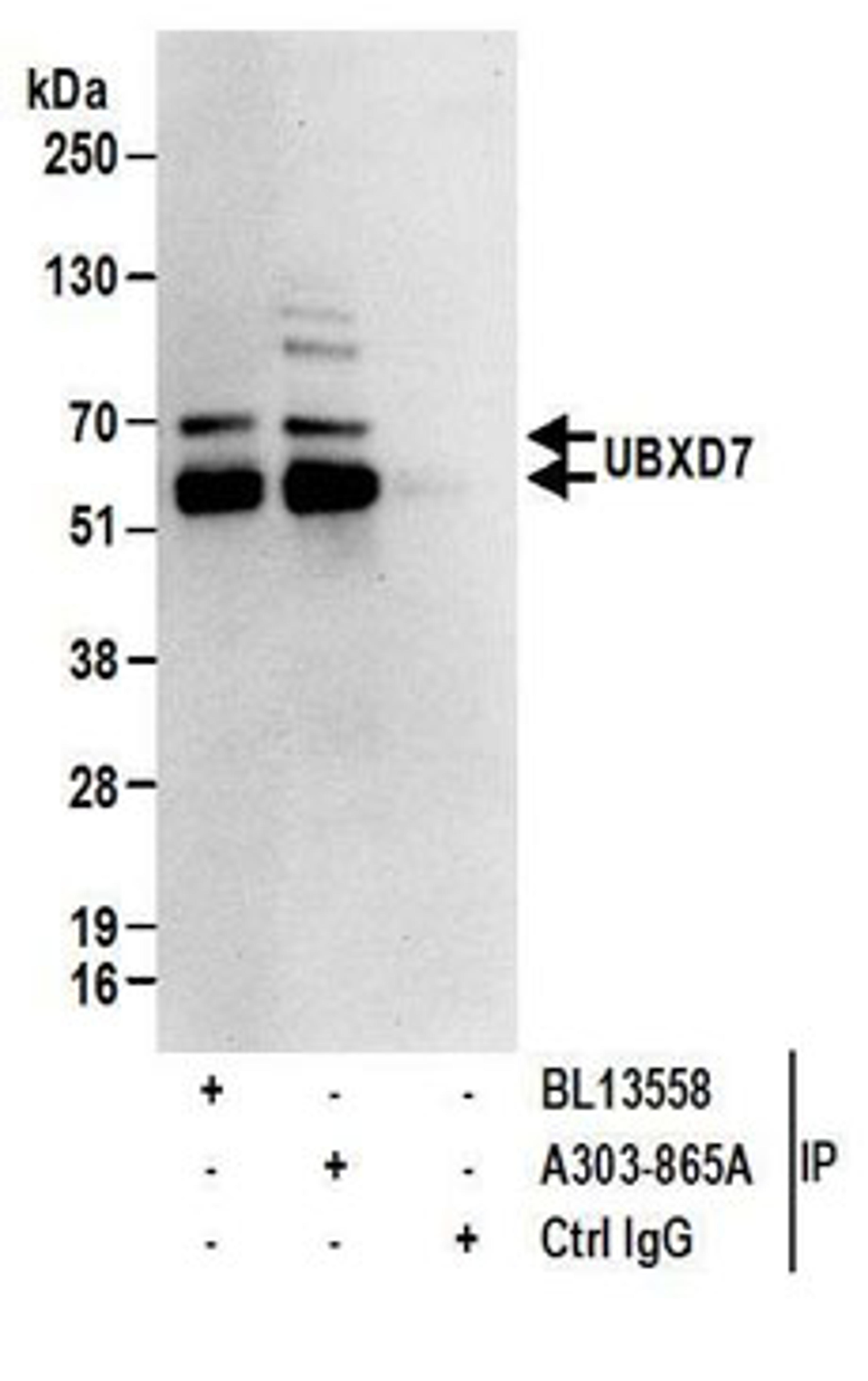 Detection of human UBXD7 by western blot of immunoprecipitates.