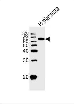 Western blot analysis of lysate from human placenta tissue lysate, using ALPI Antibody at 1:1000.