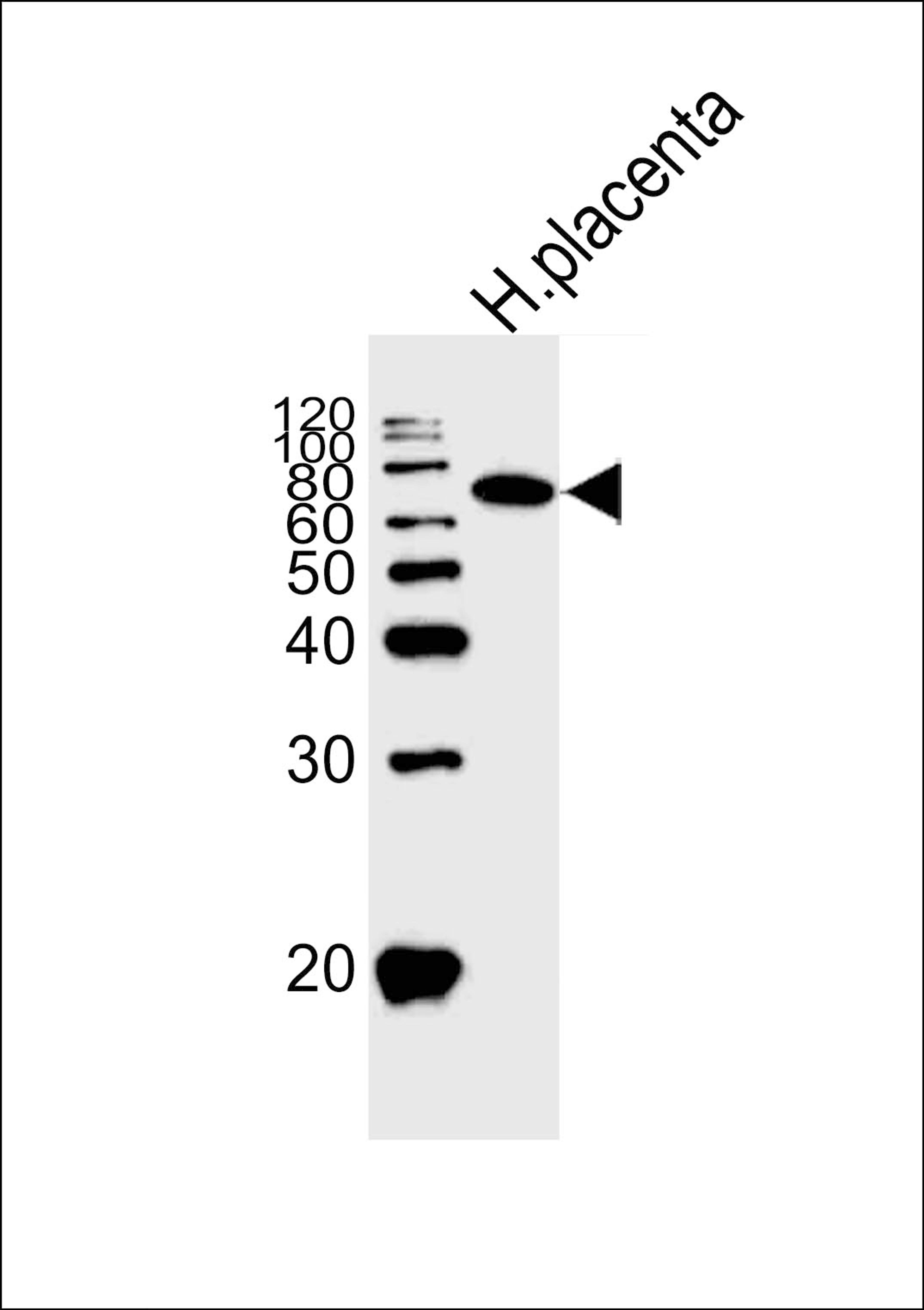 Western blot analysis of lysate from human placenta tissue lysate, using ALPI Antibody at 1:1000.