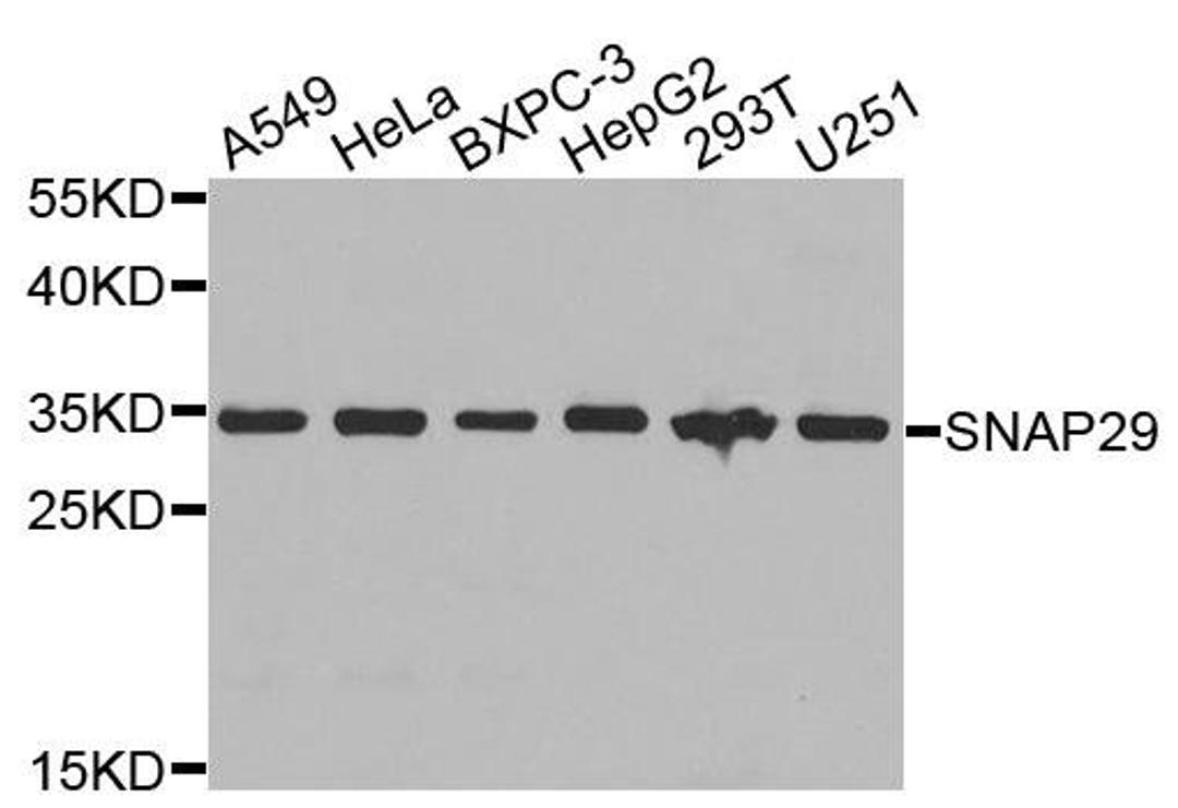 Western blot analysis of extracts of various cells using SNAP29 antibody