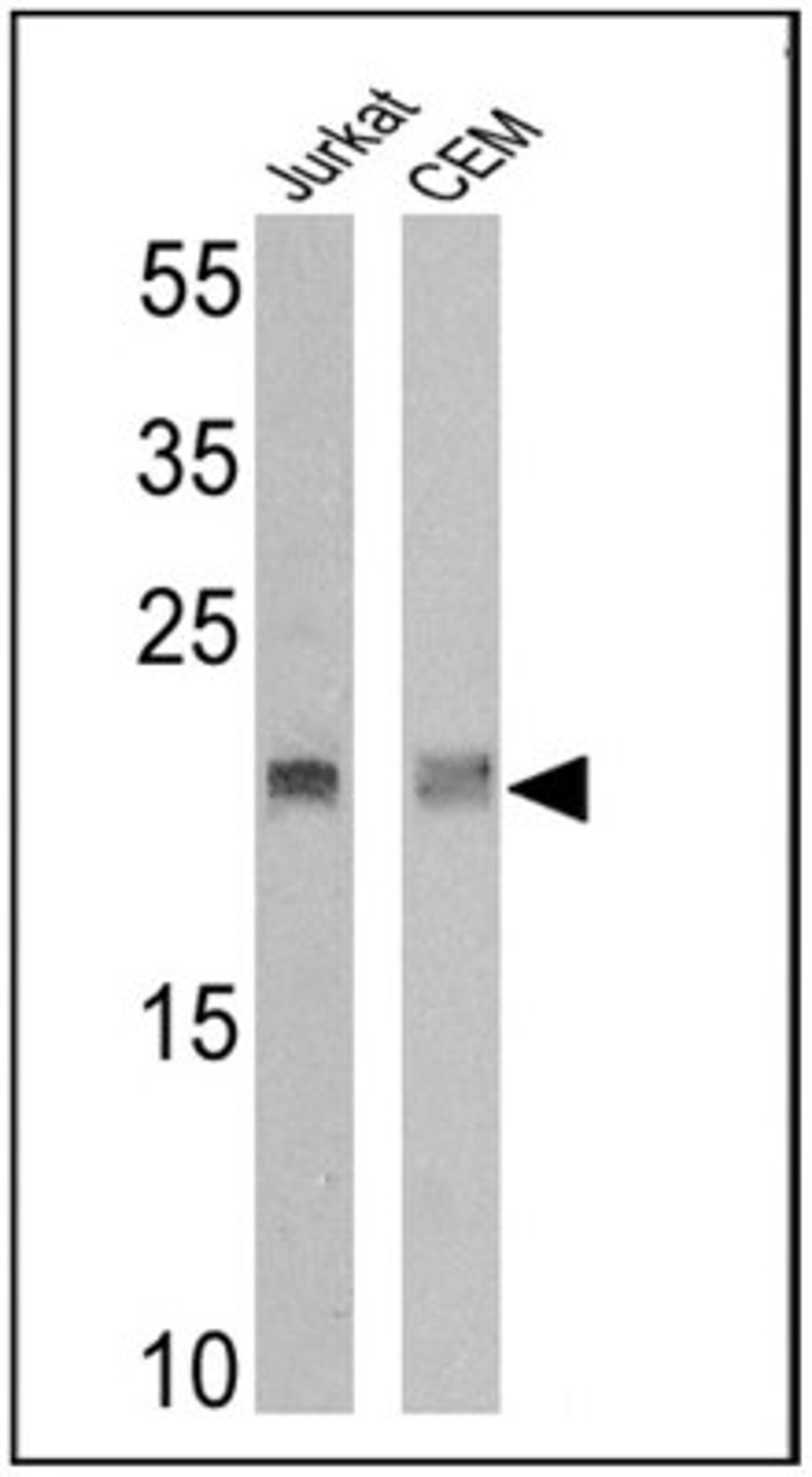 Western Blot: T cell receptor delta locus Antibody (15D) [NBP2-22508] - Analysis of 25 ug of Jurkat (lane 1) and CEM (lane 2) cell lysates.