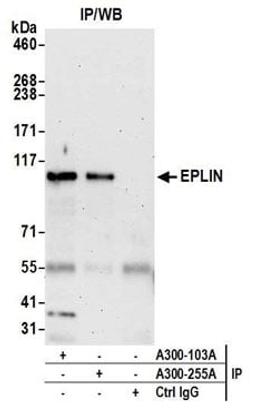 Detection of human EPLIN by western blot of immunoprecipitates.