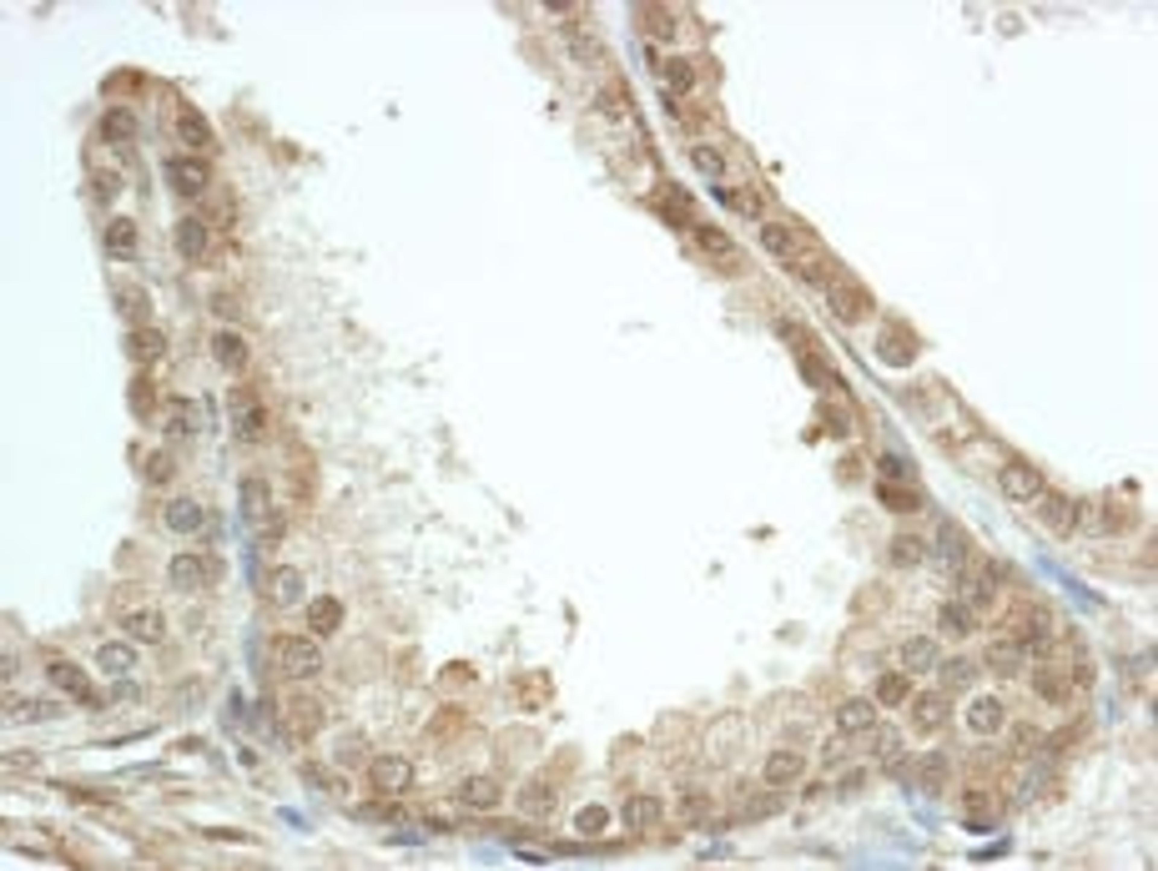 Detection of human FKBP4/FKBP52 by immunohistochemistry.