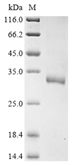 (Tris-Glycine gel) Discontinuous SDS-PAGE (reduced) with 5% enrichment gel and 15% separation gel.