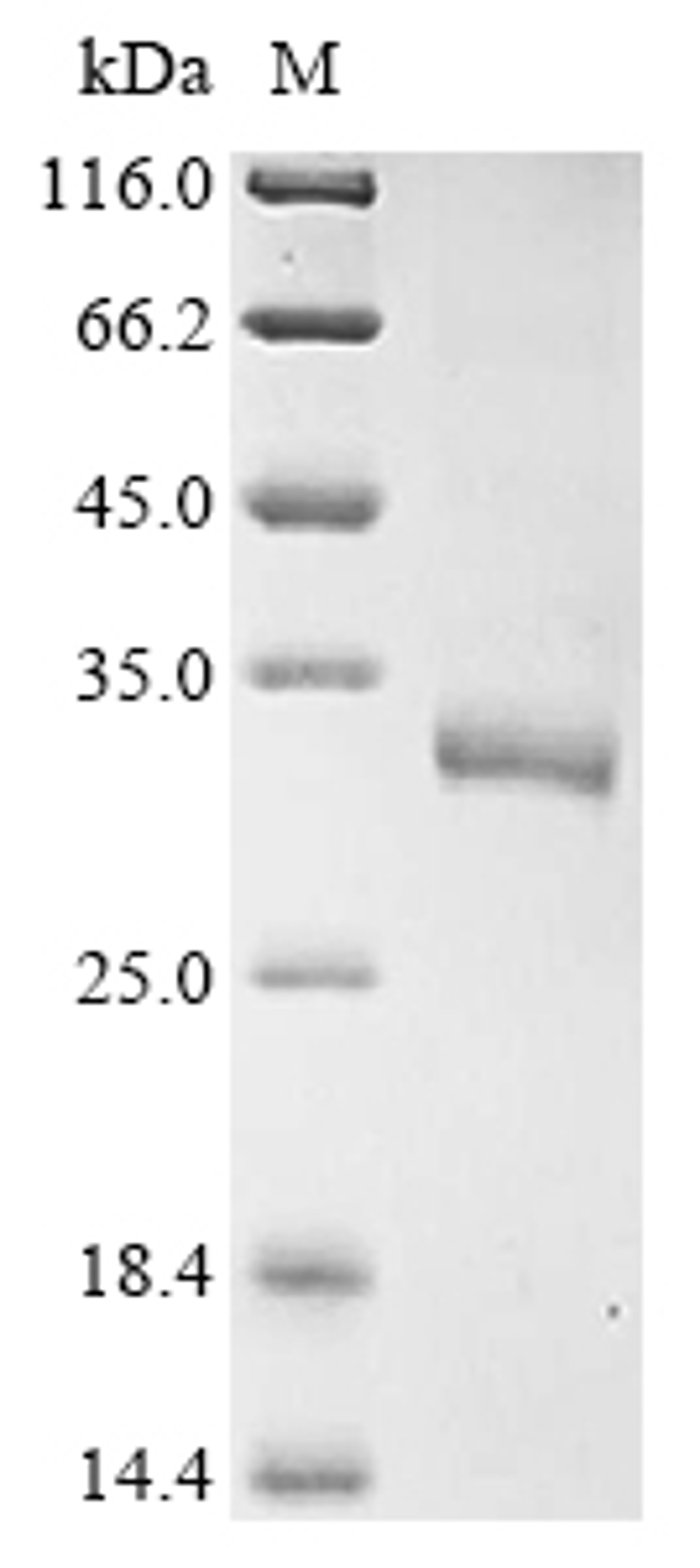(Tris-Glycine gel) Discontinuous SDS-PAGE (reduced) with 5% enrichment gel and 15% separation gel.