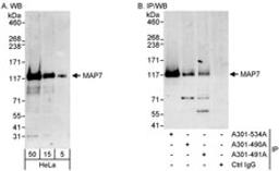 Detection of human MAP7 by western blot and immunoprecipitation.