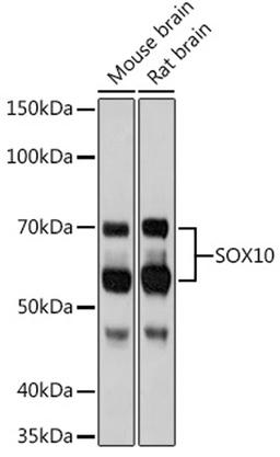 Western blot - SOX10 Rabbit mAb (A8658)