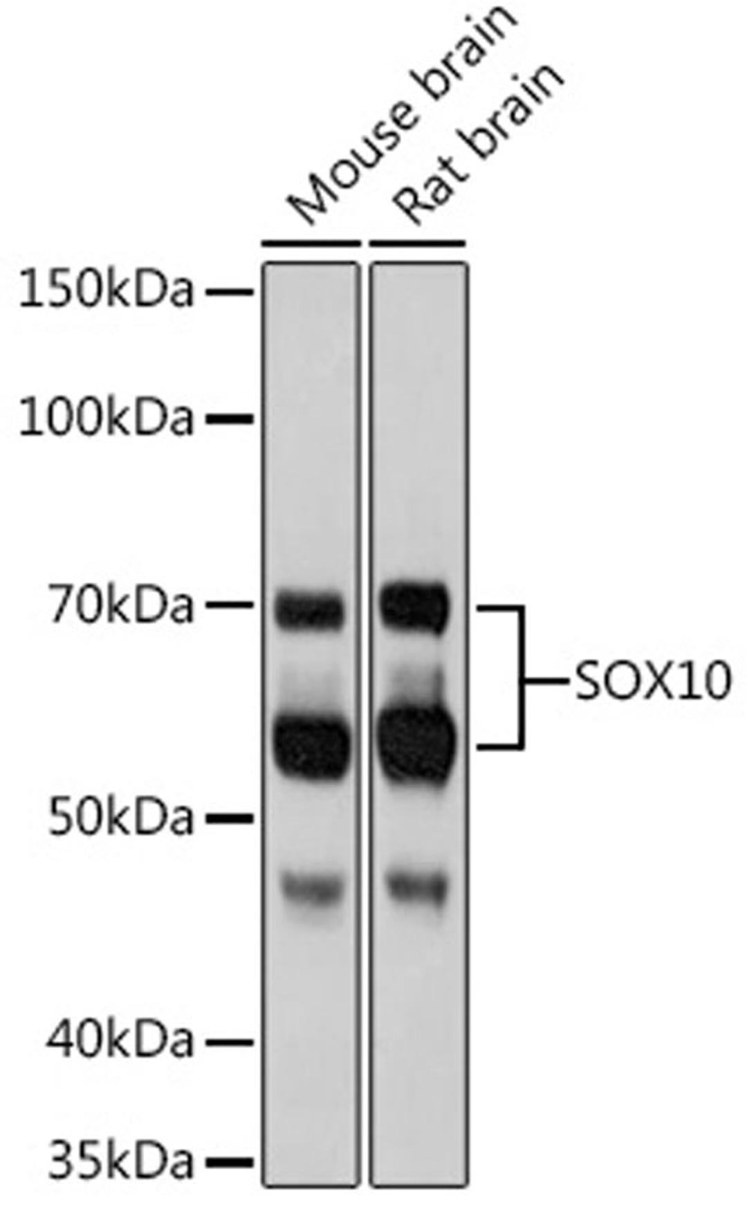 Western blot - SOX10 Rabbit mAb (A8658)