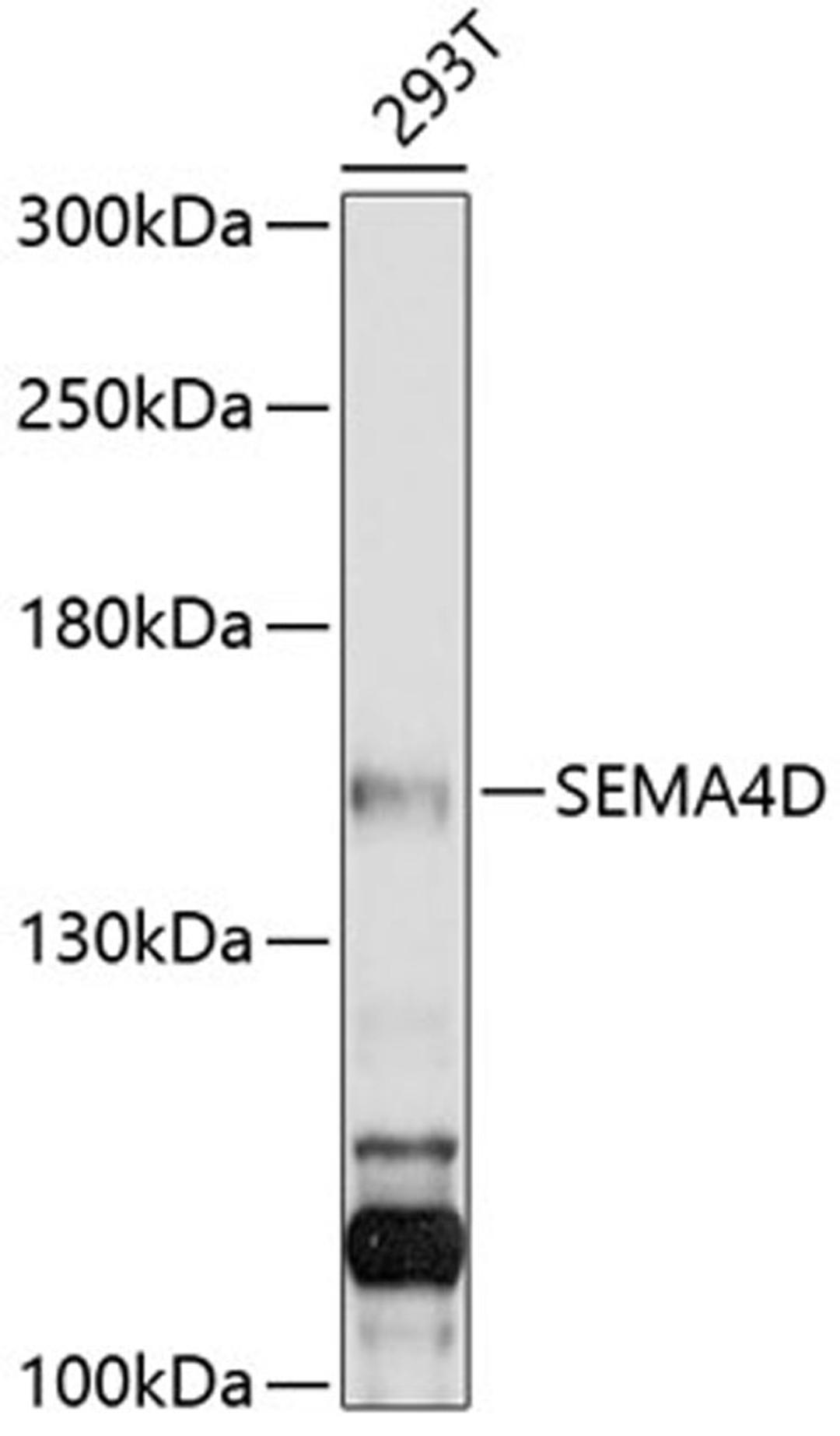 Western blot - SEMA4D antibody (A10136)