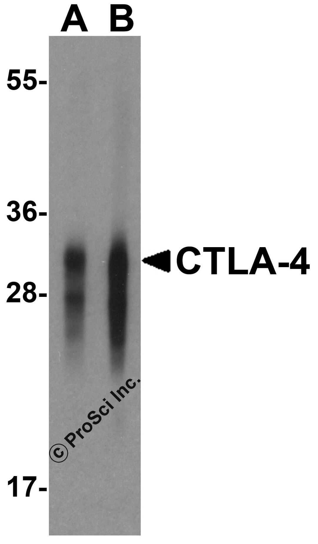 Western blot analysis of CTLA-4 in overexpressing HEK293 cells CTLA-4 antibody at 0.125 and 0.25 μg/mL.