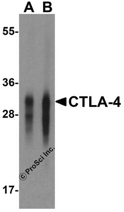 Western blot analysis of CTLA-4 in overexpressing HEK293 cells CTLA-4 antibody at 0.125 and 0.25 μg/mL.