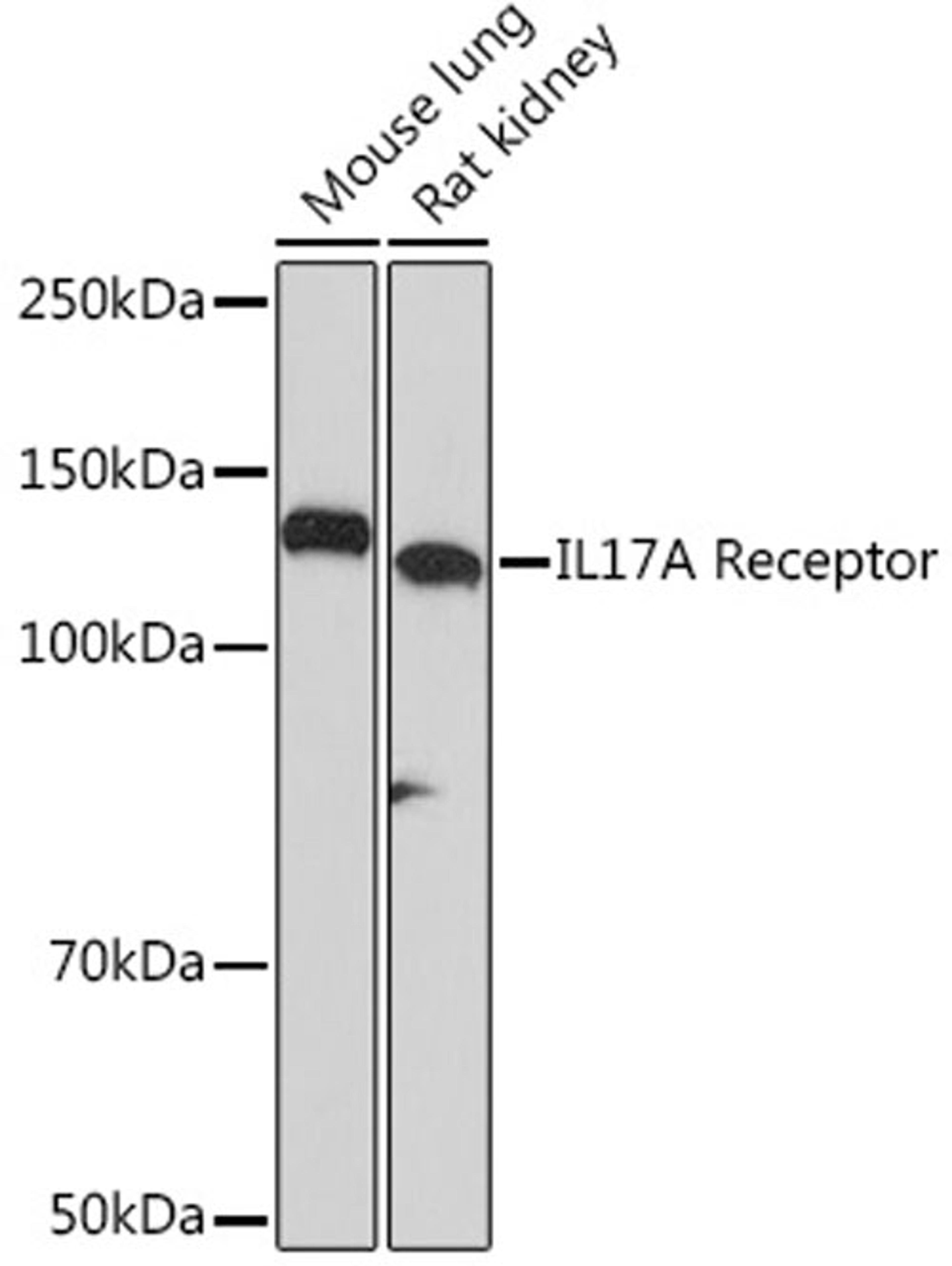 Western blot - IL17A Receptor Rabbit mAb (A5163)