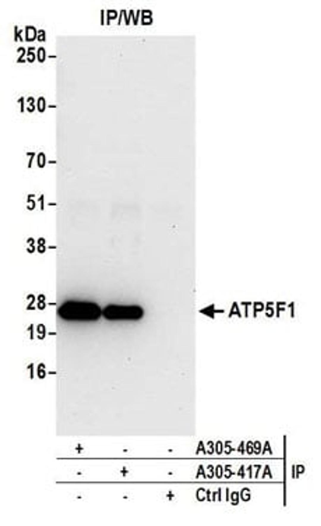 Detection of human ATP5F1 by western blot of immunoprecipitates.