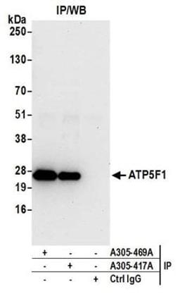 Detection of human ATP5F1 by western blot of immunoprecipitates.