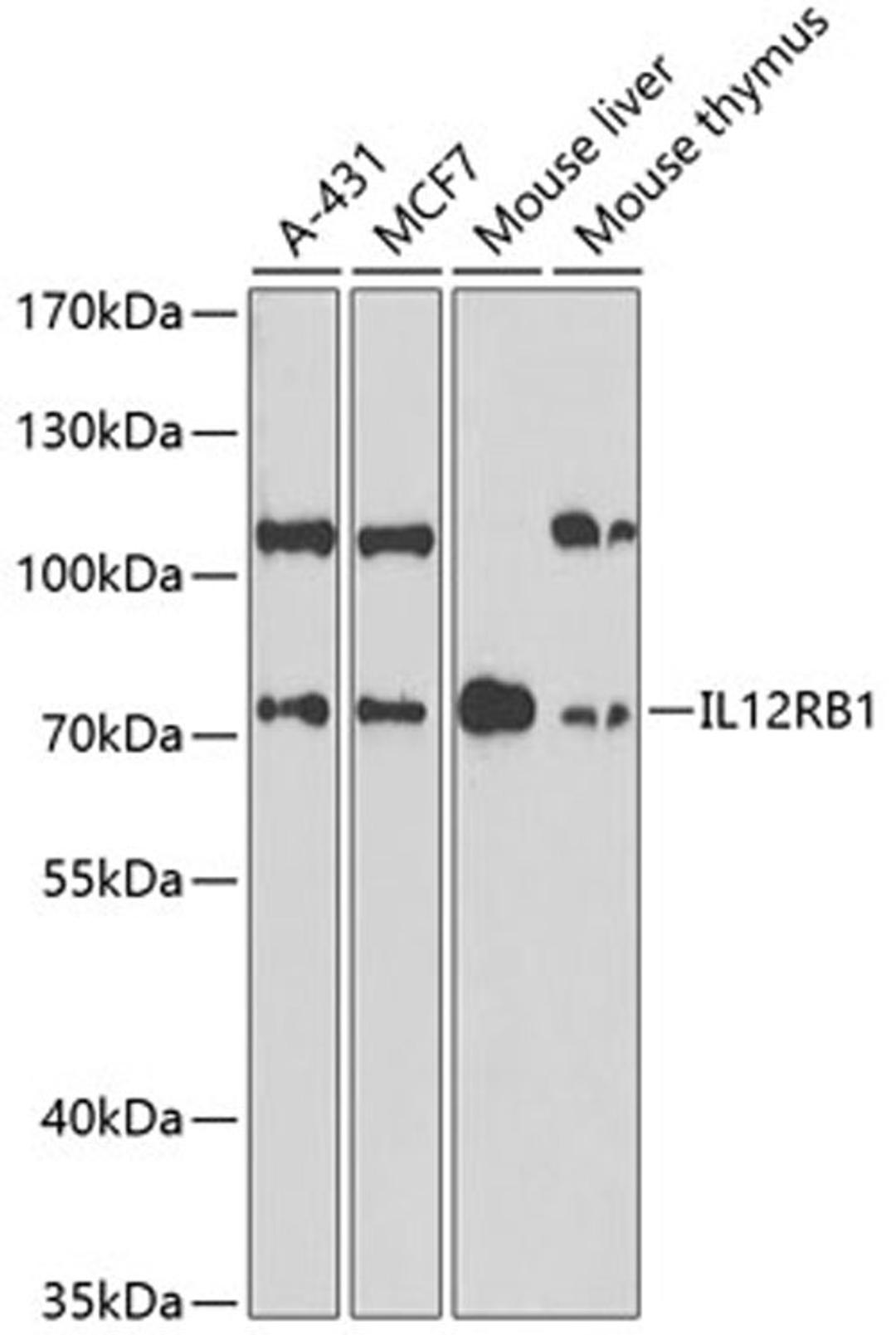 Western blot - IL12RB1 antibody (A1886)