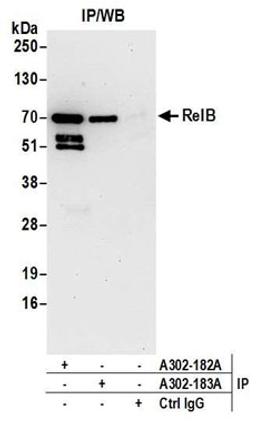 Detection of human RelB by western blot of immunoprecipitates.