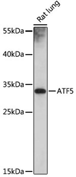 Western blot - ATF5 antibody (A18155)