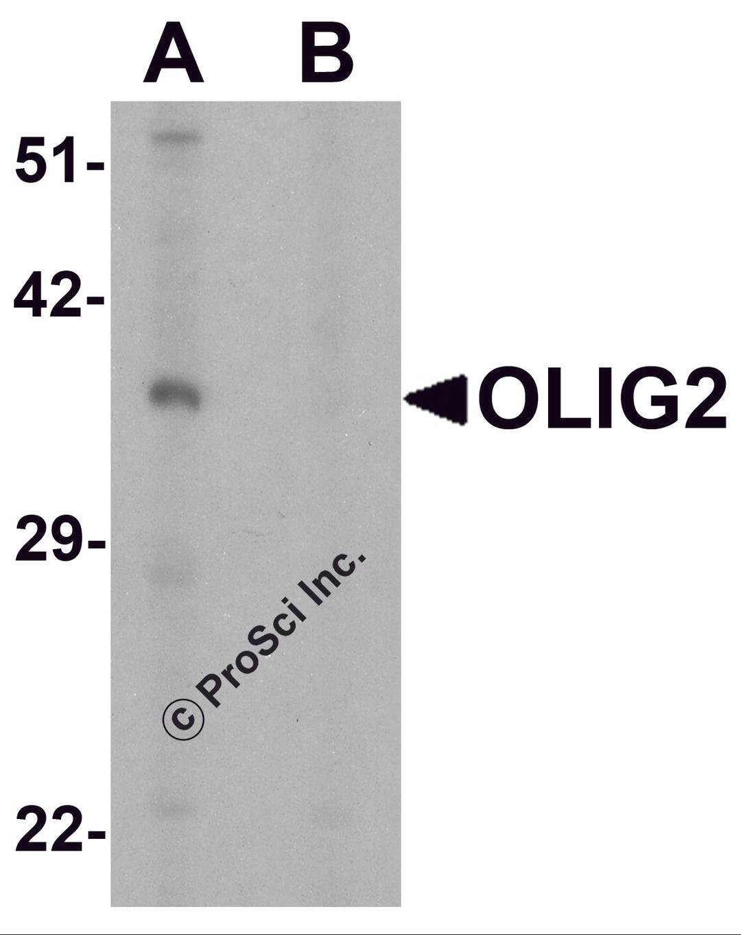 Western blot analysis of OLIG2 in EL4 cell lysate with OLIG2 antibody at 1 μg/ml in (A) the absence and (B) the presence of blocking peptide.