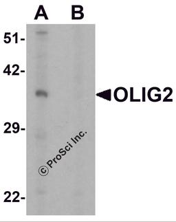 Western blot analysis of OLIG2 in EL4 cell lysate with OLIG2 antibody at 1 μg/ml in (A) the absence and (B) the presence of blocking peptide.