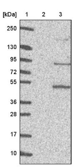 Western Blot: PATL1 Antibody [NBP1-93808] - Lane 1: Marker [kDa] 250, 130, 95, 72, 55, 36, 28, 17, 10<br/>Lane 2: Negative control (vector only transfected HEK293T lysate)<br/>Lane 3: Over-expression lysate (Co-expressed with a C-terminal myc-DDK tag (~3.1 kDa) in mammalian HEK293T cells, LY407336)