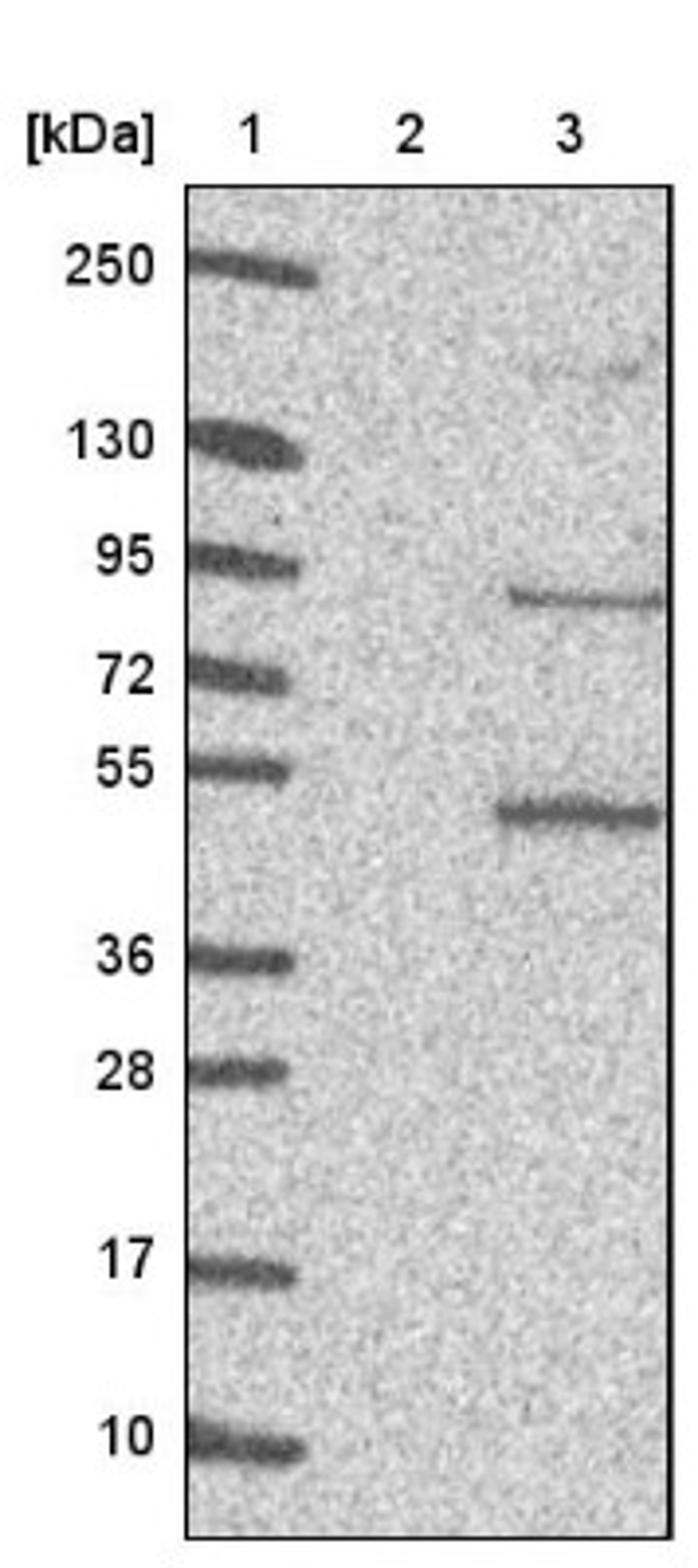 Western Blot: PATL1 Antibody [NBP1-93808] - Lane 1: Marker [kDa] 250, 130, 95, 72, 55, 36, 28, 17, 10<br/>Lane 2: Negative control (vector only transfected HEK293T lysate)<br/>Lane 3: Over-expression lysate (Co-expressed with a C-terminal myc-DDK tag (~3.1 kDa) in mammalian HEK293T cells, LY407336)