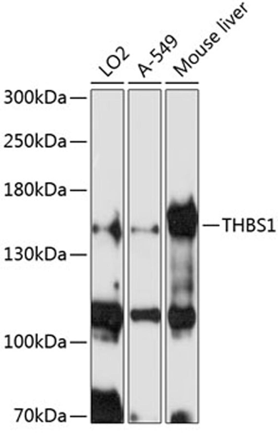 Western blot - THBS1 antibody (A2125)