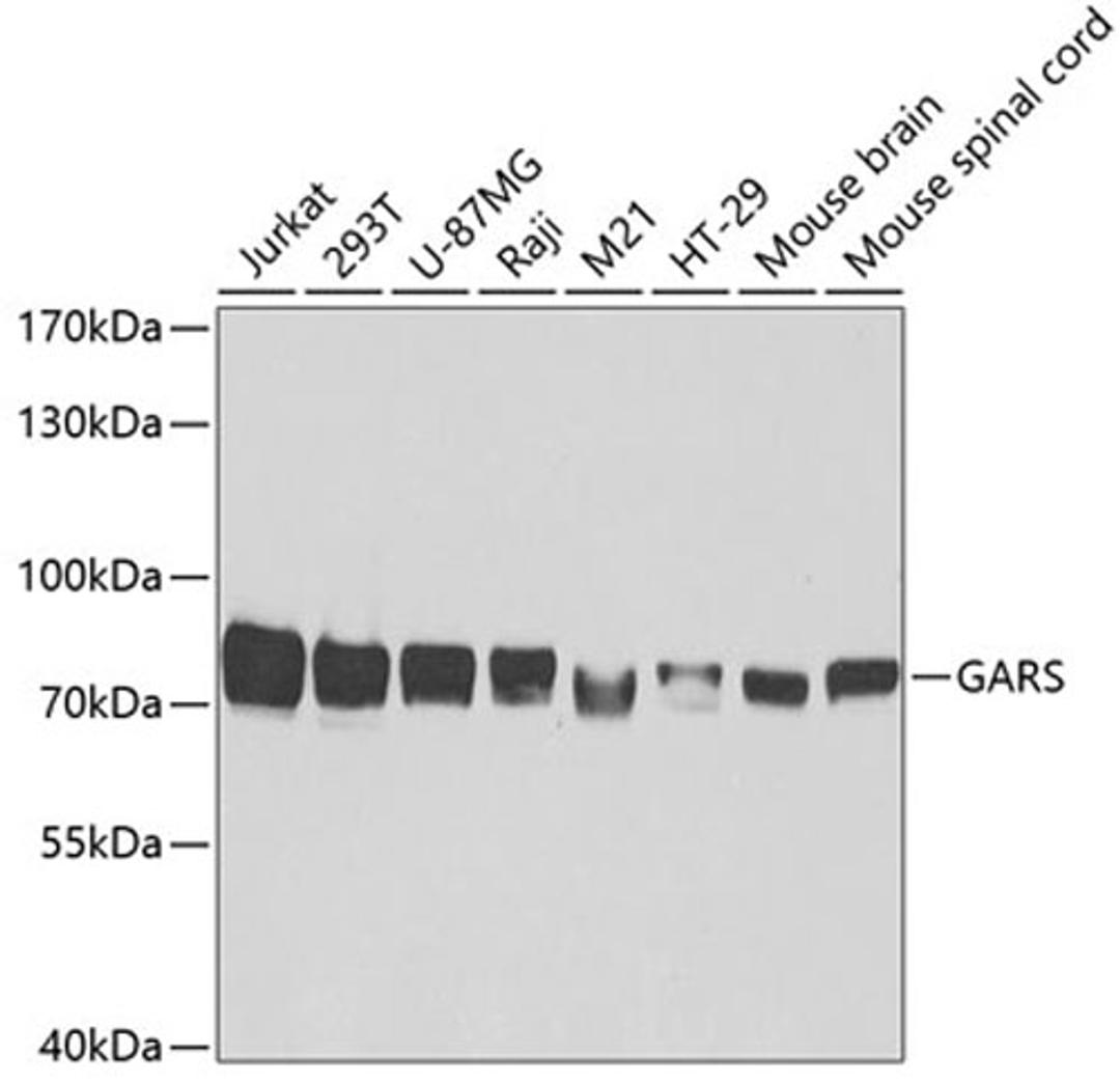 Western blot - GARS antibody (A5435)