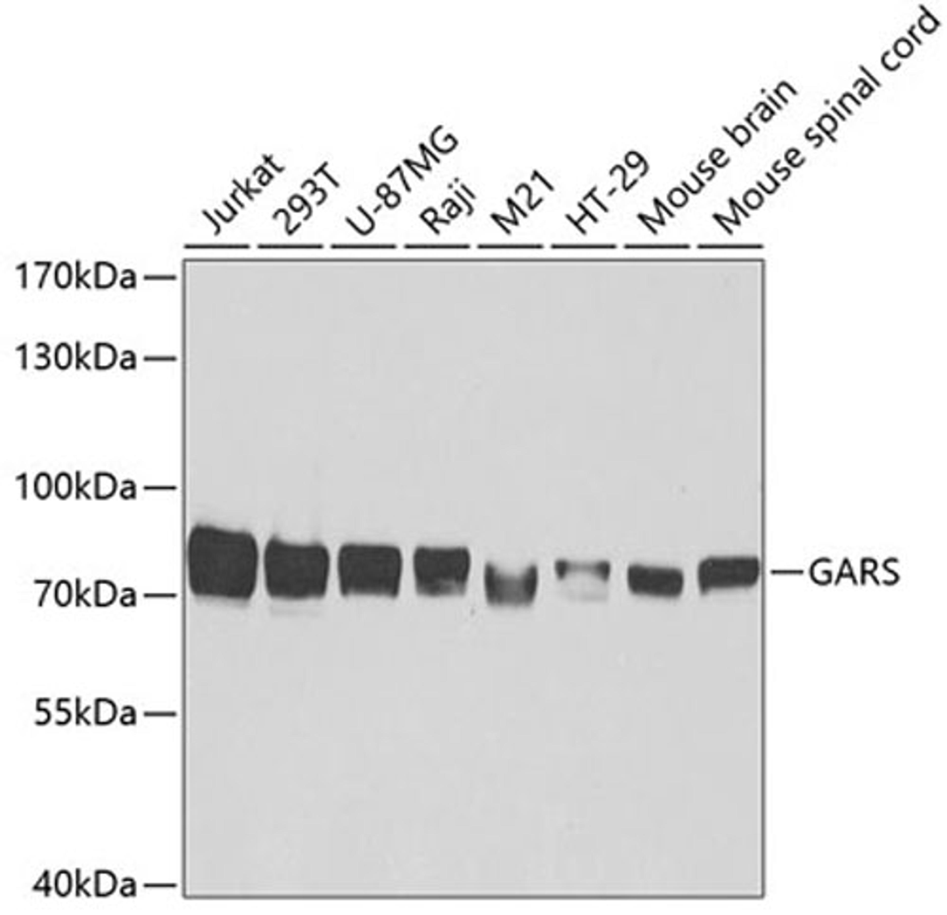 Western blot - GARS antibody (A5435)