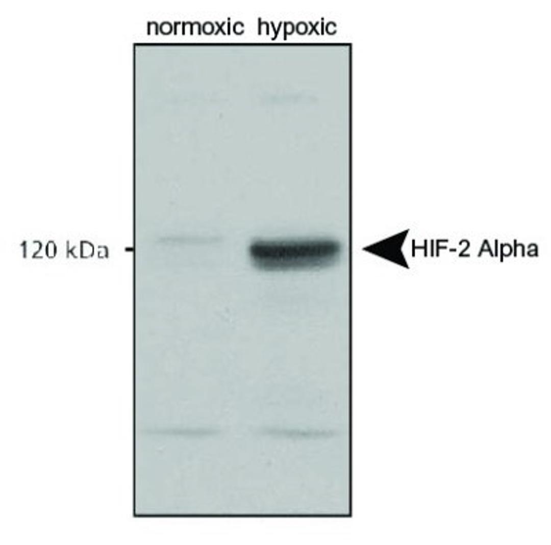 Western Blot: HIF-2 alpha/EPAS1 Antibody [NB100-122] - Analysis using the HRP conjugate of NB100-122. Detection of normoxic and hypoxic nuclear rat cell lysates.