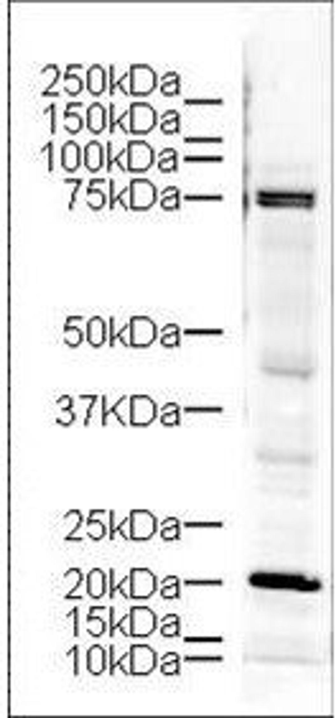 Western blot analysis of mouse brain tissue using LIM Kinase antibody