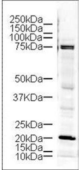 Western blot analysis of mouse brain tissue using LIM Kinase antibody