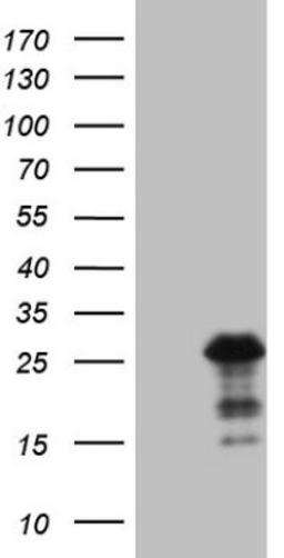 Western Blot: BMF Antibody (6F3) [NBP2-46578] - Analysis of HEK293T cells were transfected with the pCMV6-ENTRY control (Left lane) or pCMV6-ENTRY BMF .