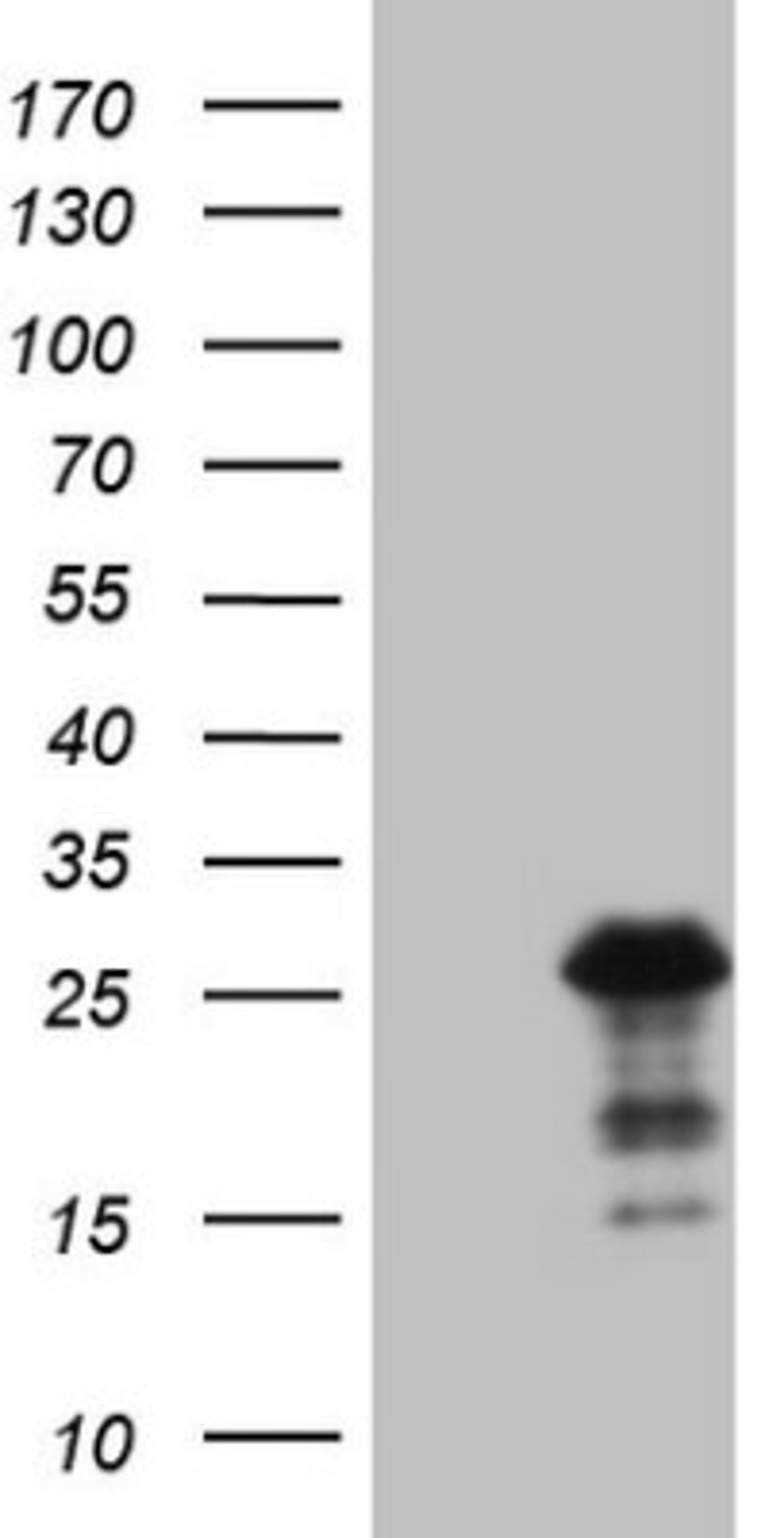 Western Blot: BMF Antibody (6F3) [NBP2-46578] - Analysis of HEK293T cells were transfected with the pCMV6-ENTRY control (Left lane) or pCMV6-ENTRY BMF .