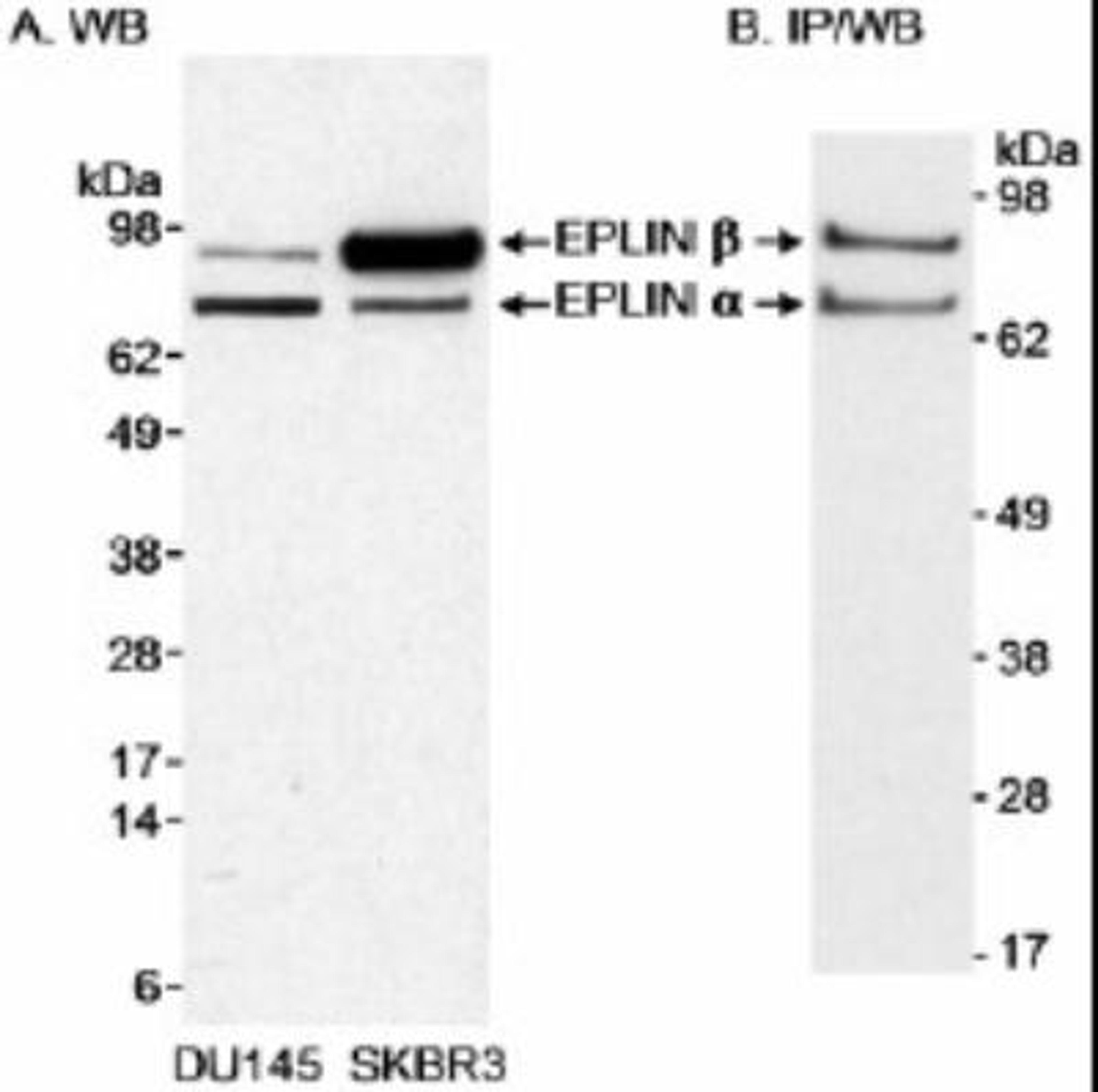 Western Blot: EPLIN Antibody [NB100-2305] - Detection of Human EPLIN by Western Blot. Samples:  A) Whole cell lysate (50 mcg) from DU145 and SKBR3 cells. B) EPLIN that was immunoprecipitated from 500 mcg of whole cell lysate from DU145 cells.  Antibodies:  Affinity purified rabbit anti-EPLIN antibody NB100-2035 was used at 0.3 mcg/ml (A) or 1 mcg/ml (B) for WB. In B, EPLIN was immunoprecipitated using another rabbit anti-EPLIN antibody.  Detection: Chemiluminescence with exposure times of 30 minutes (A) or 30 seconds (B).