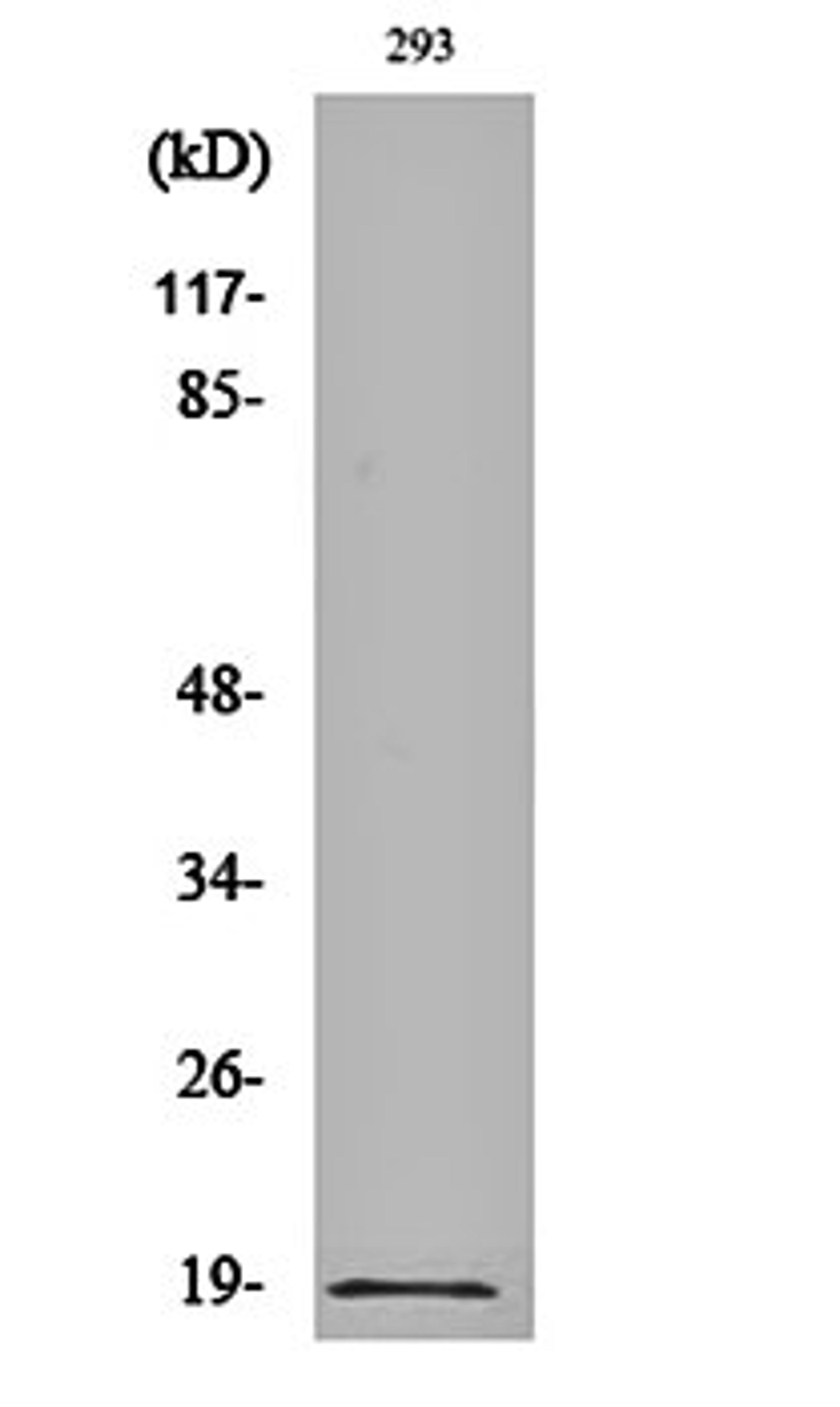 Western blot analysis of 293 cell lysates using Op18 (phospho-S16) antibody