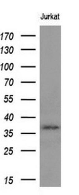 Western Blot: Mcl-1 Antibody (10F6) [NBP2-45773] - Analysis of extracts (10ug).