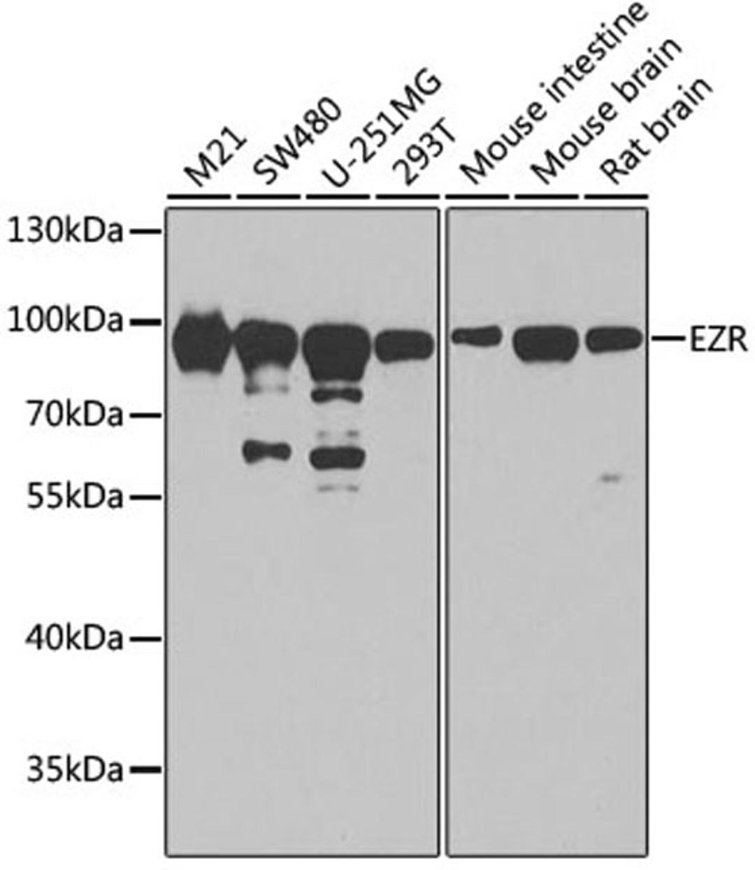 Western blot - EZR antibody (A0703)