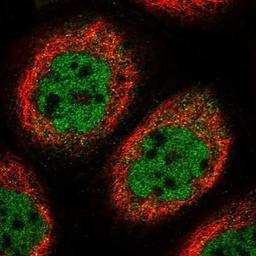 Immunocytochemistry/Immunofluorescence: CAIN Antibody [NBP1-91745] - Staining of human cell line A-431 shows positivity in nucleus but not nucleoli & cytoplasm.