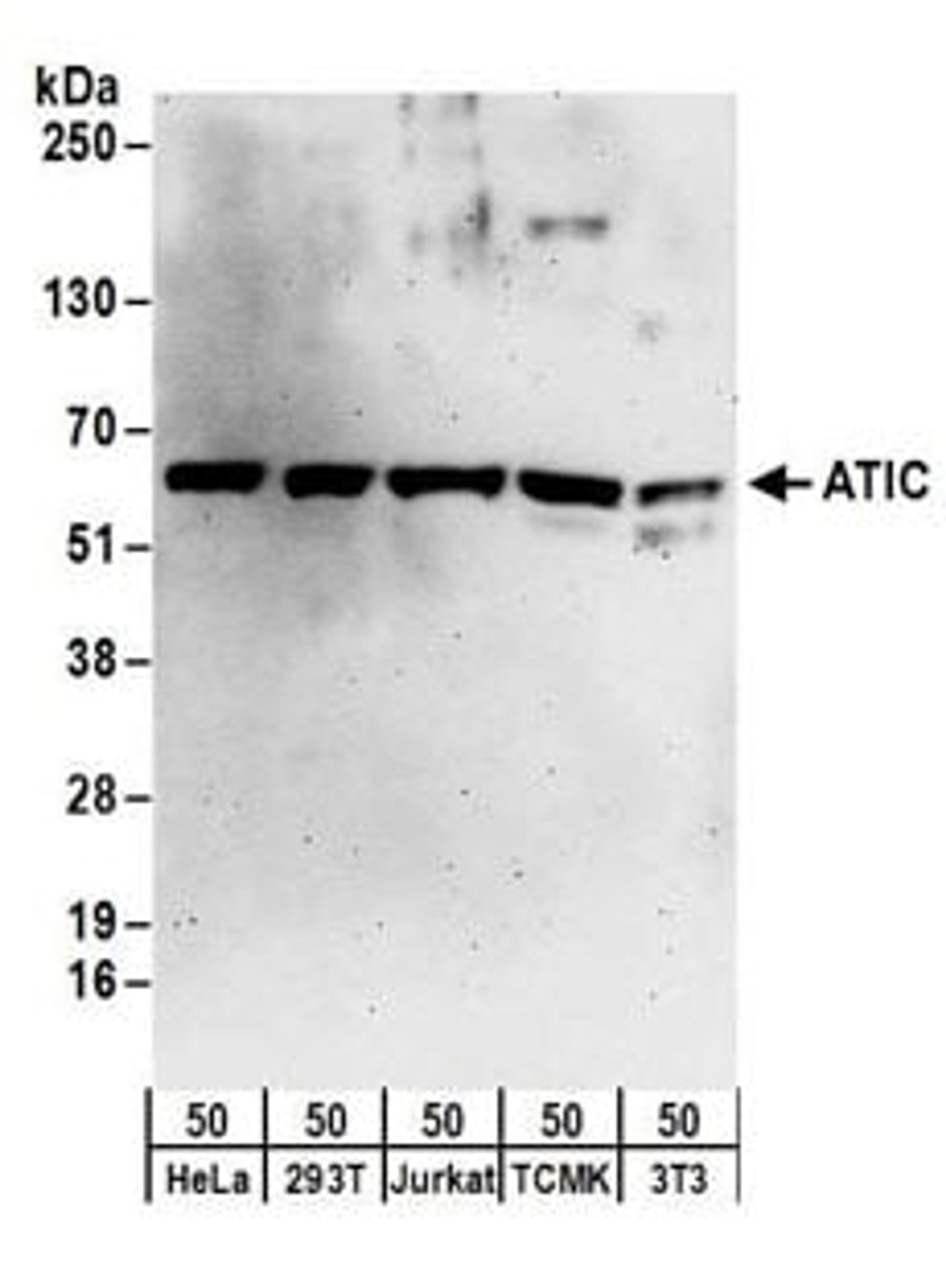 Detection of human ATIC by western blot.